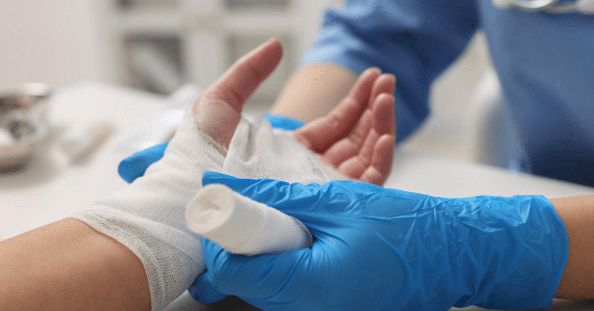 Read more about the article Nursing Care for Patients with Burns: Essential Guidelines and Best Practices
